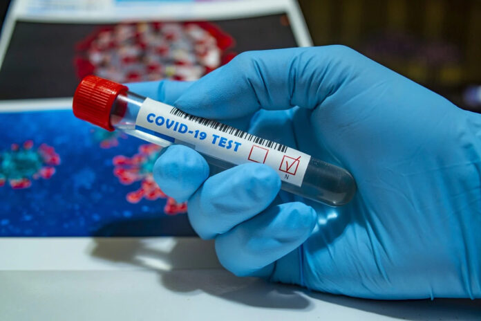 Coronavirus in Campania: un morto e 25 nuovi guariti