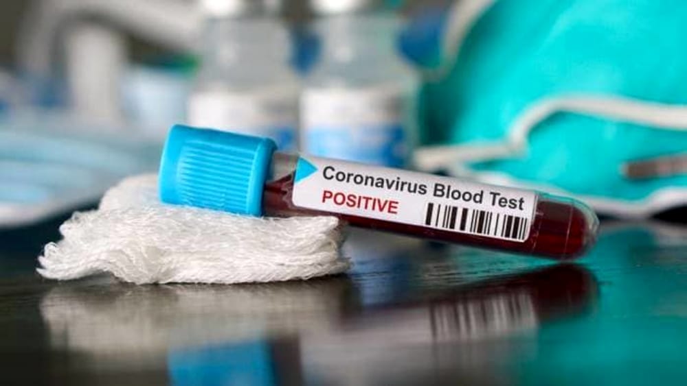 Corona Virus in Campania, ecco il bollettino di oggi Mercoledì 21 Ottobre 2020